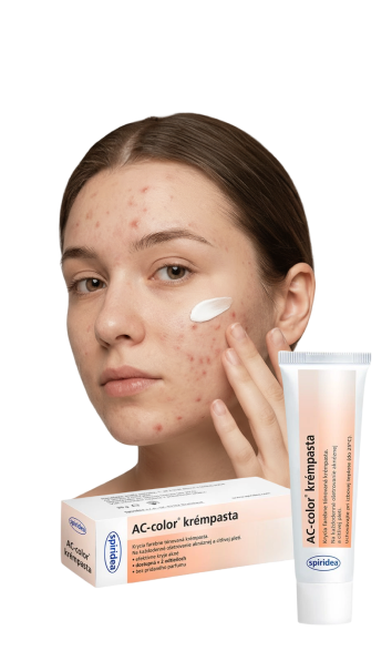 Acne on the face