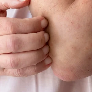 Itchy skin