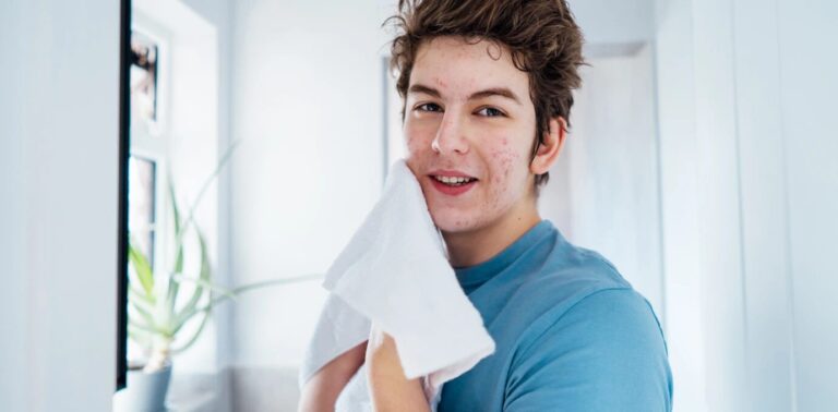 Teenage care for very sensitive skin